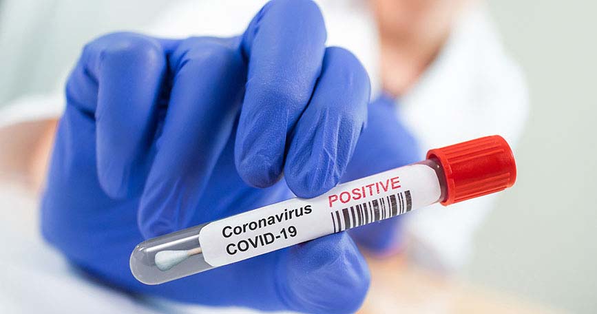 El peor día: se reportaron 42 nuevos contagios de Covid-19 en Funes